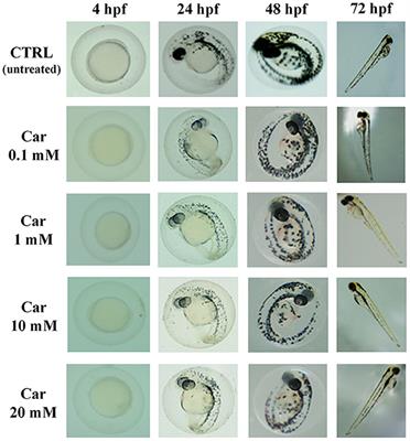 Effects of carnosine on the embryonic development and TiO2 nanoparticles-induced oxidative stress on Zebrafish